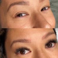 Angela Carley - Valley Skin & Laser Clinic image 1